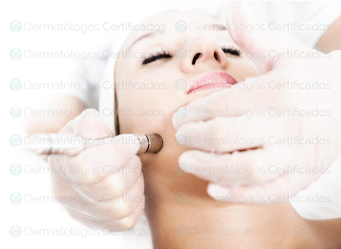 microdermoabrasión