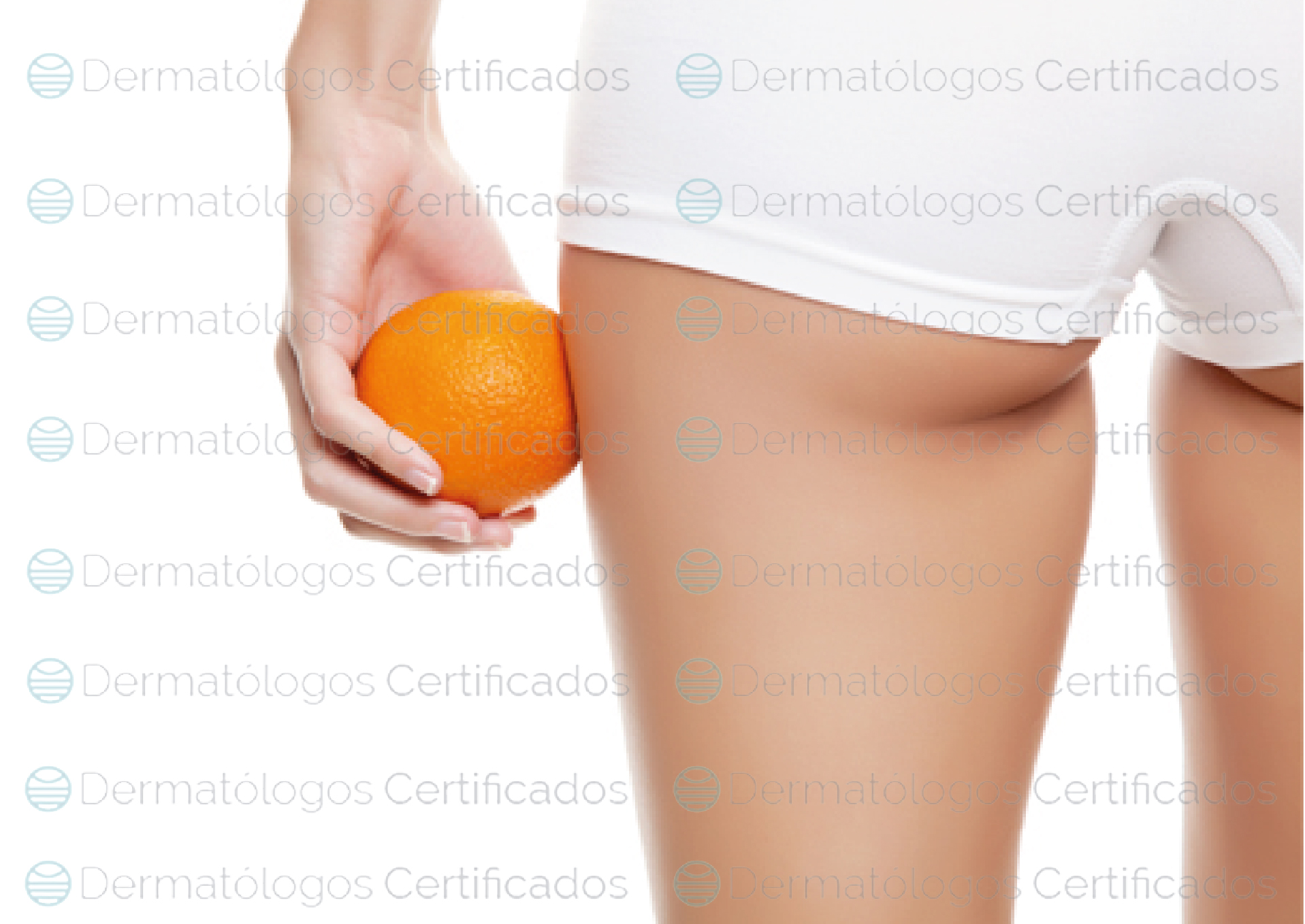 Celulitis