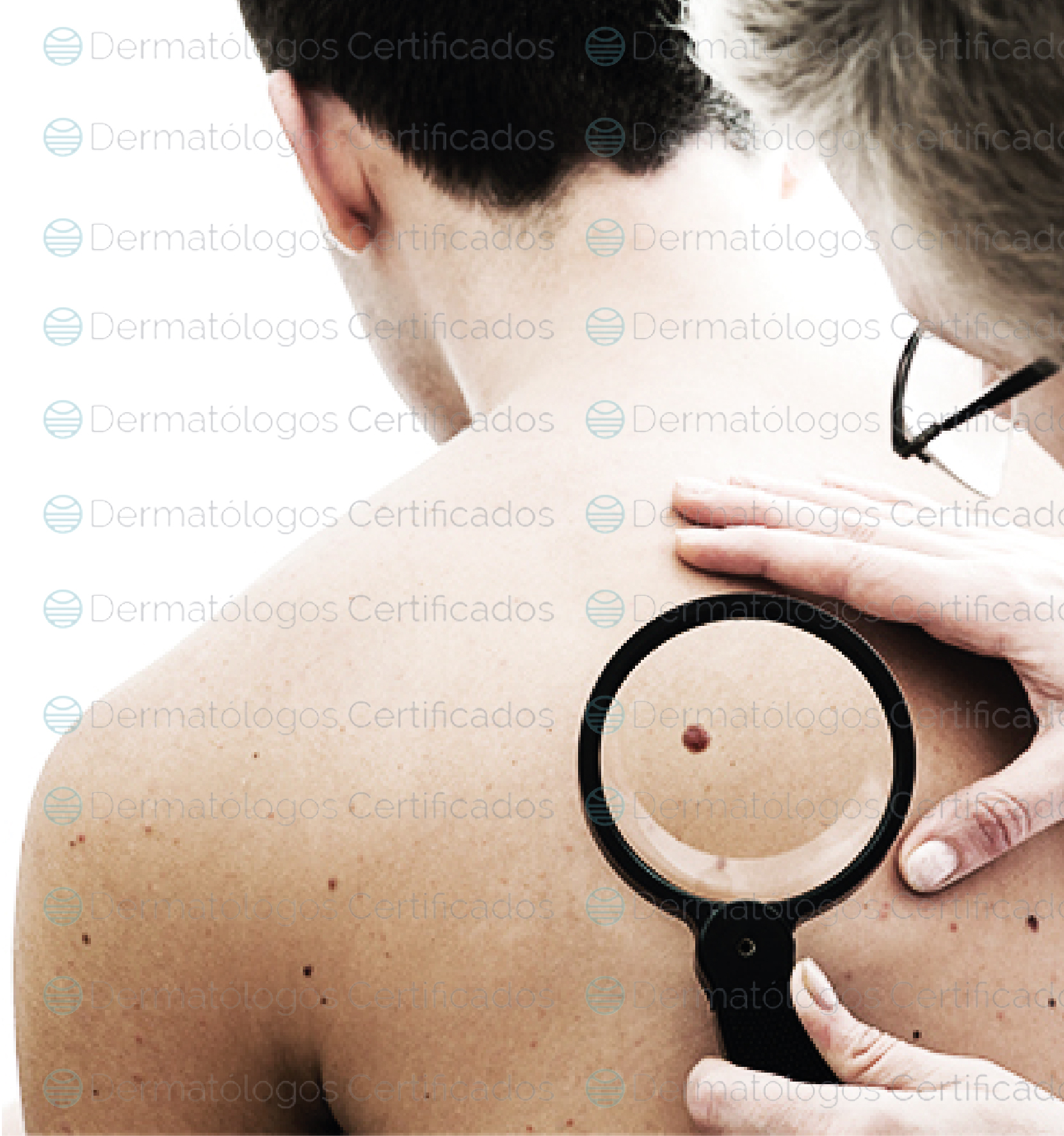 Crioterapia